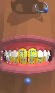 牙医模拟器截图1